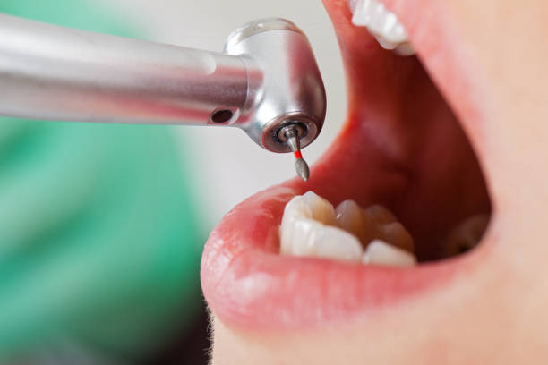 Best Emergency Dental Care for Trauma or Injury in Clinton, OK